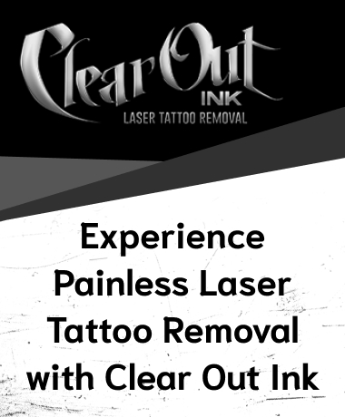 Laser Tattoo Removal in Las Vegas