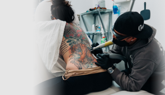 Tattoo Removal in Las Vegas