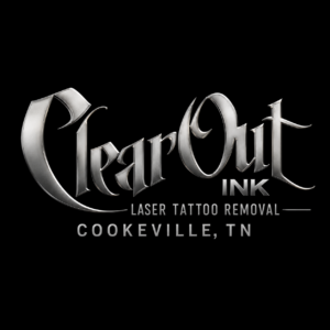 Laser tattoo removal in Cookeville, Tennessee